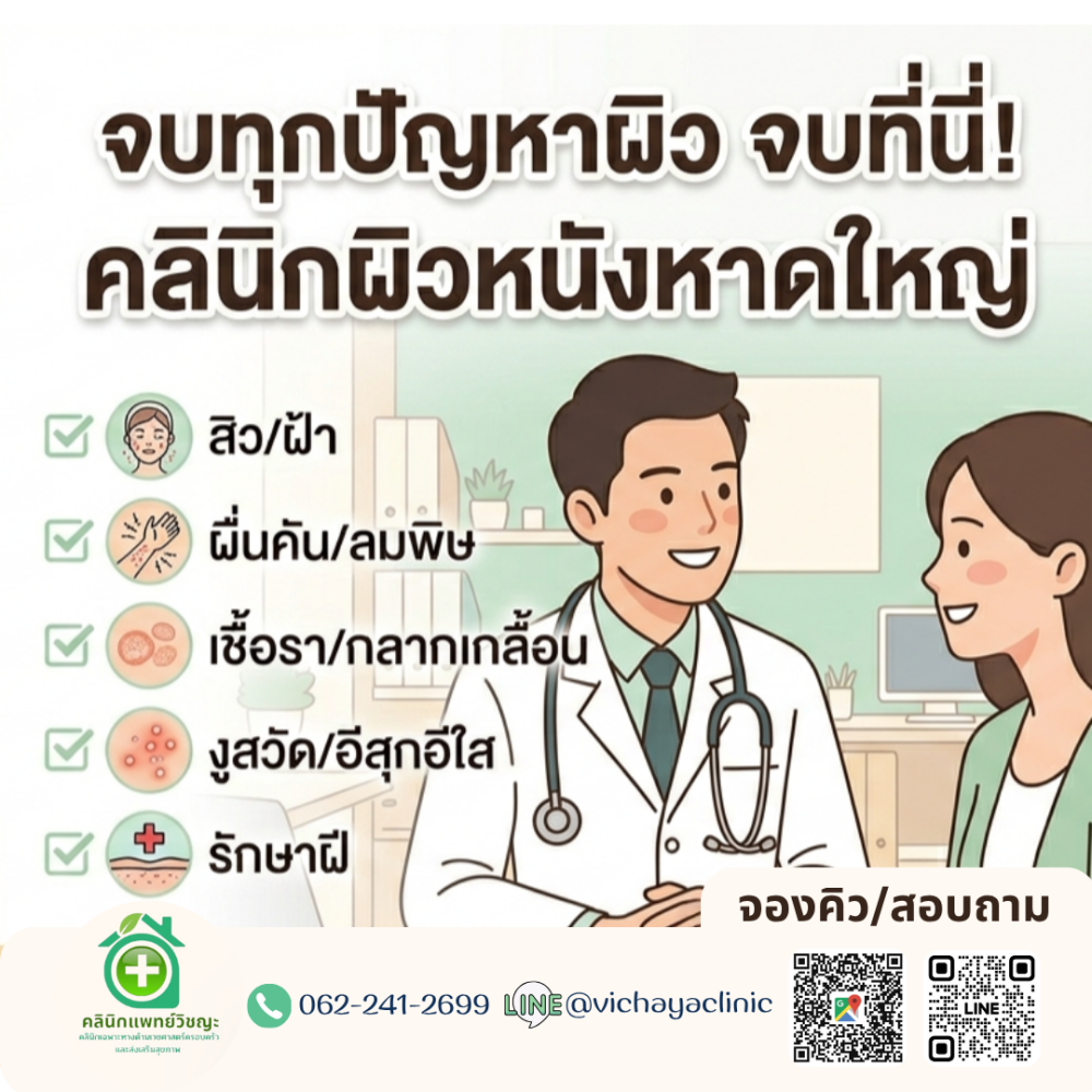 Service